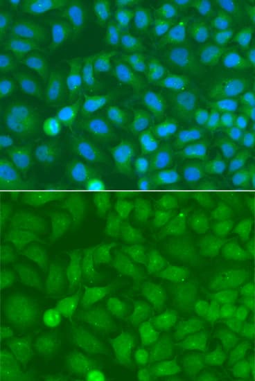 NCK1 / NCK Antibody