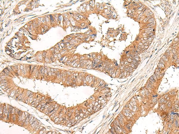 Polyclonal Rabbit anti-Human CORO2A Antibody (IHC)