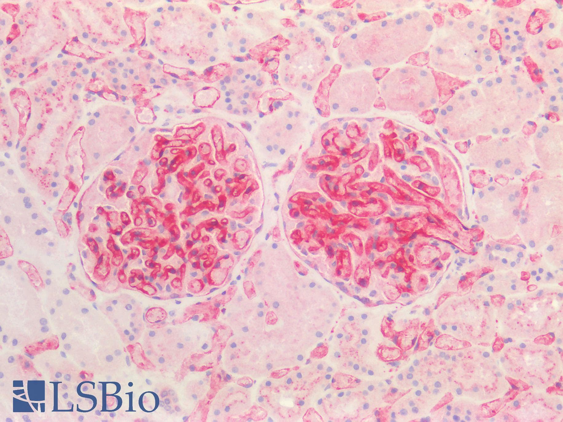 PathPlus™ B2M / Beta 2 Microglobulin Antibody (clone OTI1A9)