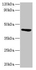 ST3GAL3 / ST3N Antibody