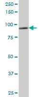 DDX1 Antibody (clone 4F6)