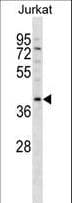 DNMT3L Antibody (aa355-381)