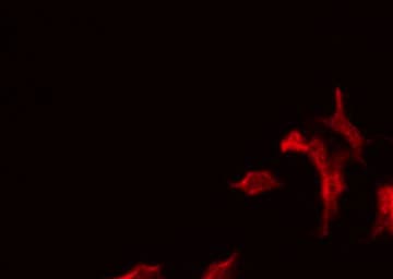 SLC5A2 / SGLT2 Antibody