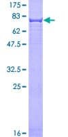 Human KRT4 / CK4 / Cytokeratin 4 Protein (Recombinant GST)