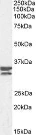 FCN3 / Ficolin-3 Antibody