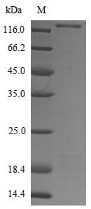 Aspergillus kawachii eglD Protein (Recombinant 6His-SUMOstar, N-terminus)