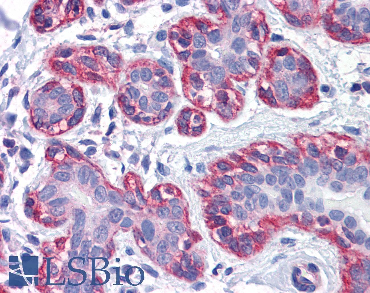 IHC-plus™ Zyxin Antibody (clone 2D1)