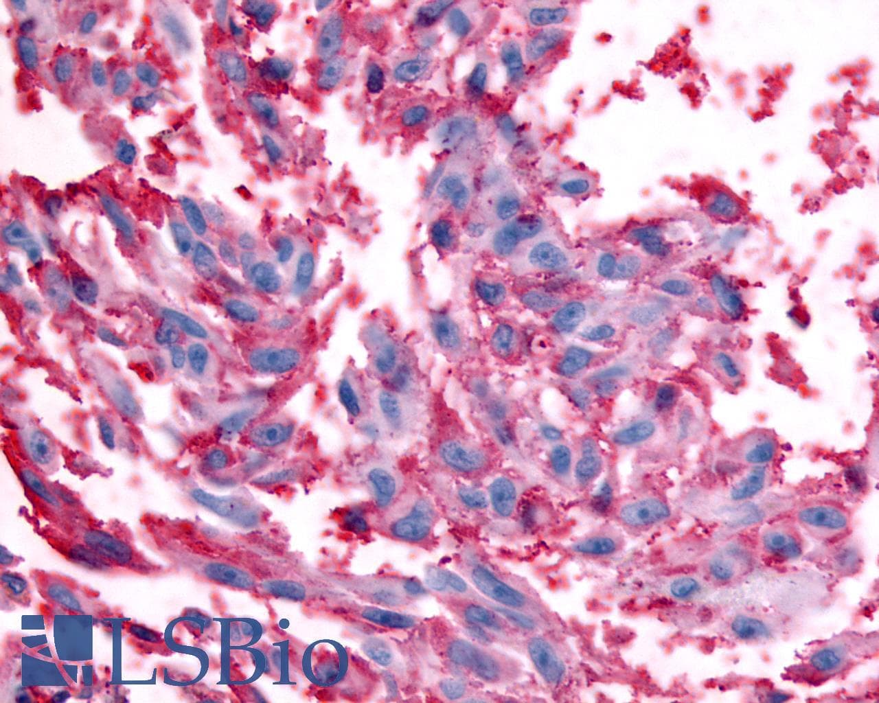 PathPlus™ Polyclonal Rabbit anti-Human RXFP2 / LGR8 Antibody (Extracellular Domain, IHC)