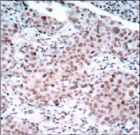 Polyclonal Rabbit anti-Human ER Alpha / Estrogen Receptor Antibody (IHC, WB)