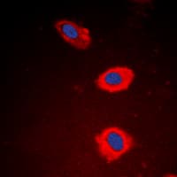 NT5C1B Antibody (Internal)