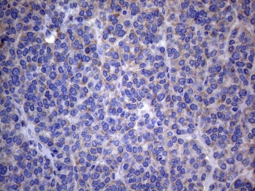 AKIP1 / BCA3 Antibody (clone OTI2E4)
