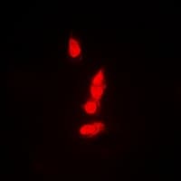 Polyclonal Rabbit anti-Human PSMB8 / LMP7 Antibody (IHC, IF, WB)