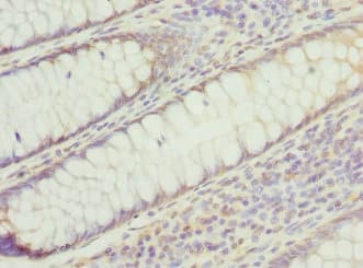 PSMD8 / RPN12 Antibody
