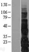 TGFA / TGF Alpha Protein (Over-Expression Lysate Myc-DDK (Flag))