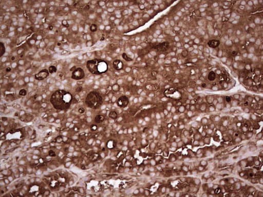 TG / Thyroglobulin Antibody (aa20-358, clone OTI8F7)