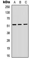 VIPR1 Antibody (Internal)