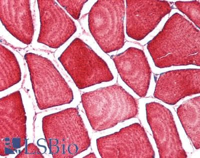 TPM2 Antibody (aa1-284)