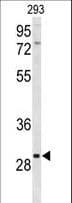 CLRN3 Antibody (aa196-222)