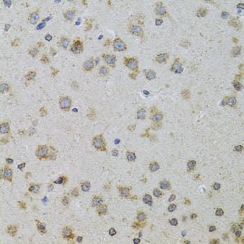 Polyclonal Rabbit anti-Human PDYN / ProDynorphin Antibody (IHC, WB)