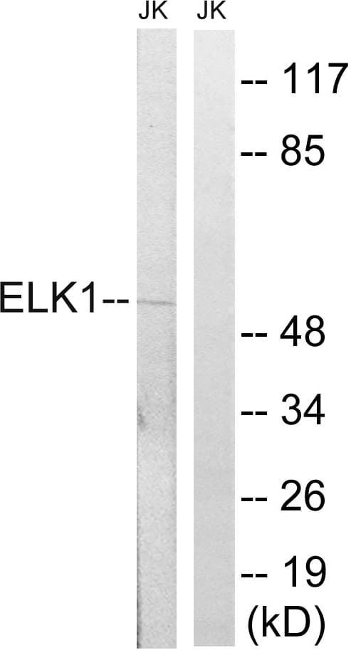 ELK1 Antibody (aa351-400)