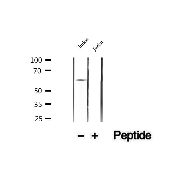 HPSE / Heparanase Antibody