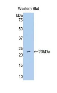 IFNA10 / Interferon Alpha 10 Antibody (aa24-189)