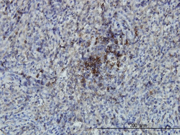 Monoclonal Mouse anti-Human SWAP70 Antibody (clone 3H8, IHC, WB)