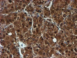 PSMB9 Antibody (clone OTI2B6)