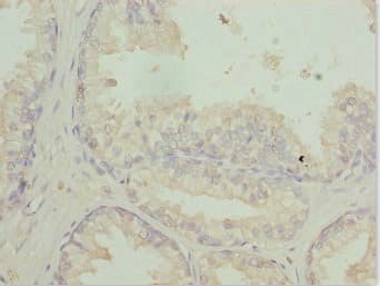 Polyclonal Rabbit anti-Human RFPL2 Antibody (IHC, WB)
