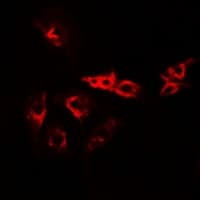 Polyclonal Rabbit anti-Human VPS37A Antibody (IHC, IF, WB)