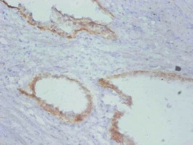 TIMP1 Antibody