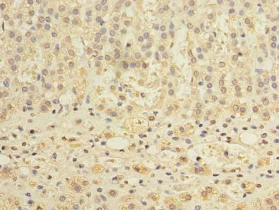 TCTE1 Antibody