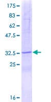 Human SPINK2 Protein (Recombinant GST)