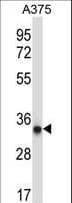 PRKAB2 / AMPK Beta 2 Antibody (aa3-33)