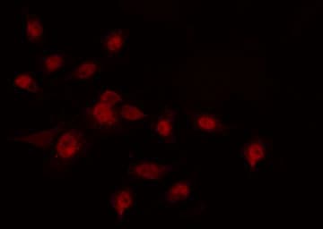 HOXA7 Antibody