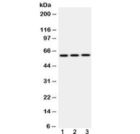 Polyclonal Rabbit anti-Human EPHX2 / Epoxide Hydrolase 2 Antibody (WB)
