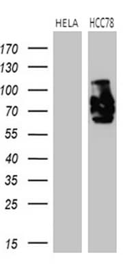 Monoclonal Mouse anti-Human ROS1 / ROS Antibody (clone OTI1E6, aa2126-2347, IHC, WB)