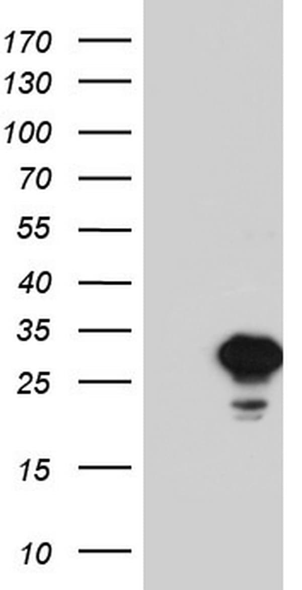 SPA17 / Sperm Protein 17 Antibody (clone OTI1D9)