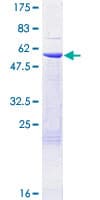 Human RPA4 Protein (Recombinant GST)