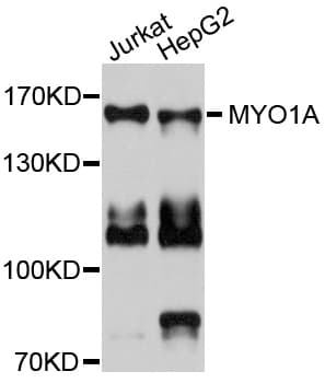 Polyclonal Rabbit anti-Human MYO1A Antibody (WB)