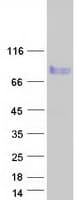 Human MARCKS Protein (Recombinant Myc-DDK (Flag))