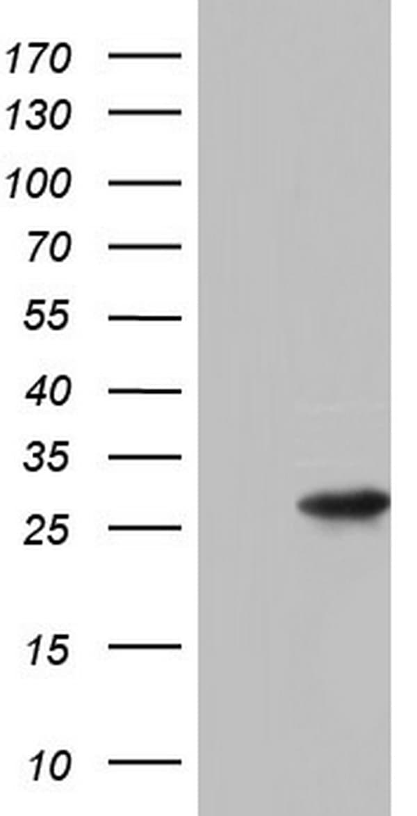 PAFAH1B3 Antibody (clone OTI5B3)