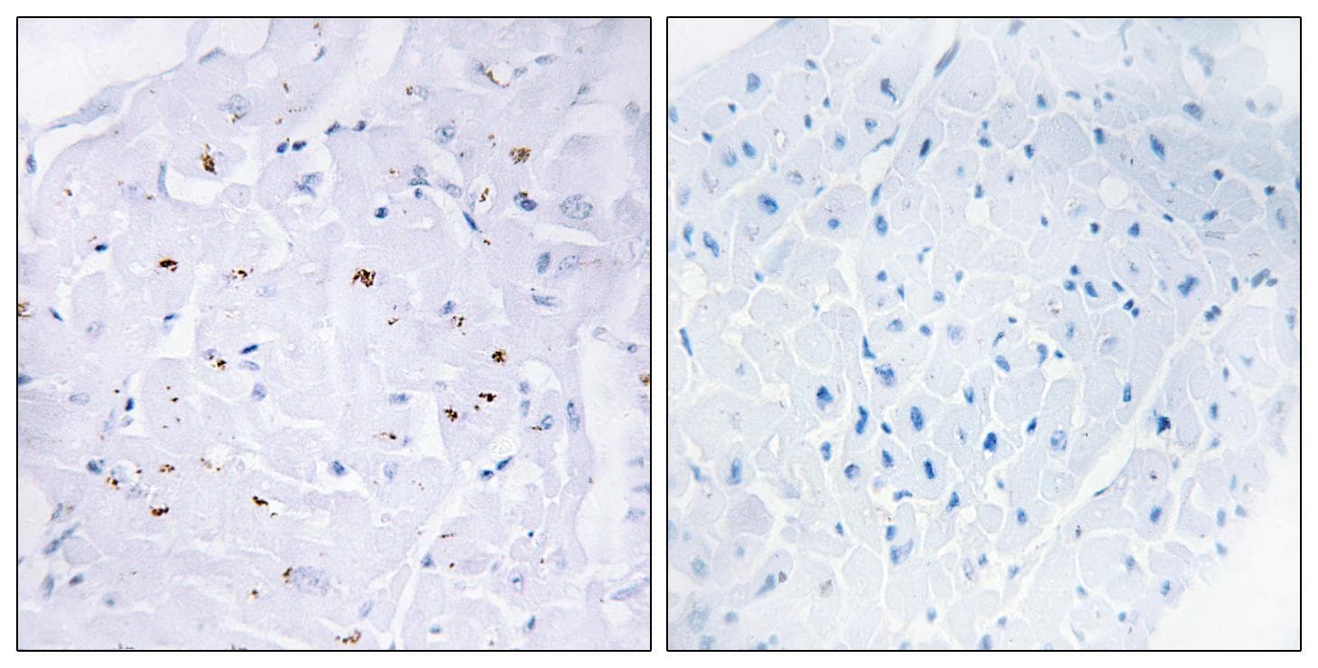 SMAD3 Antibody (phospho-Thr179)