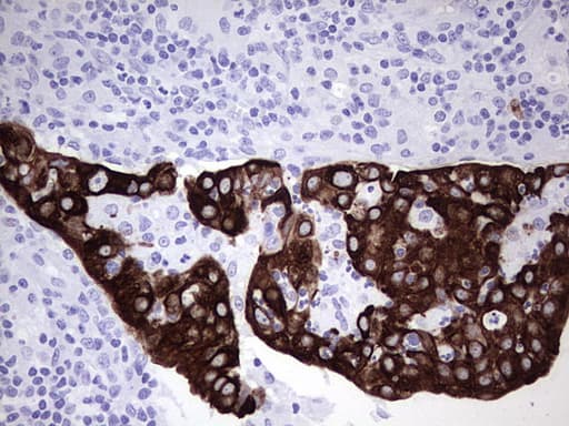 KRT7 / CK7 / Cytokeratin 7 Antibody (aa1-114, clone UMAB161)