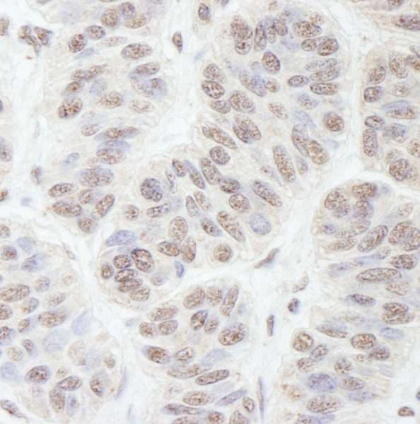 GNL3 / NS / Nucleostemin Antibody (aa1-50)