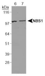 NBN / Nibrin Antibody (Internal)