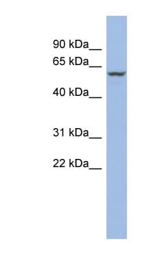 PPARA / PPAR Alpha Antibody (aa51-100)