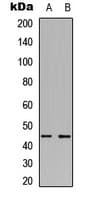 Polyclonal Rabbit anti-Human MEK1 + MEK2 Antibody (Internal, IHC, WB)