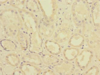 PTPMEG / PTPN4 Antibody