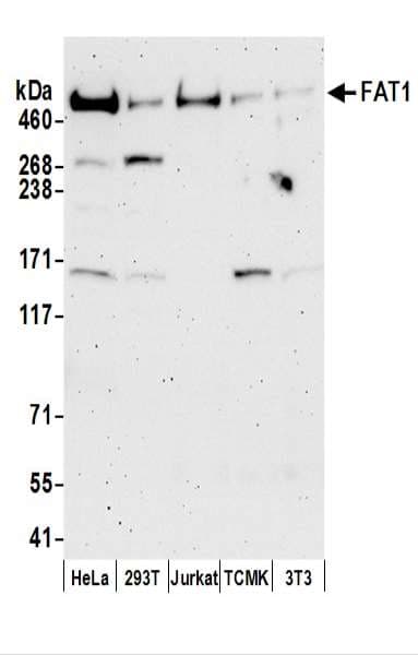 IHC-plus™ FAT1 / FAT Antibody (aa4450-4500)